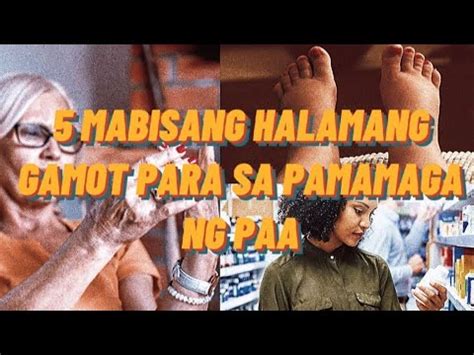 5 Mabisang Halamang Gamot Sa Pamamaga ng Paa.